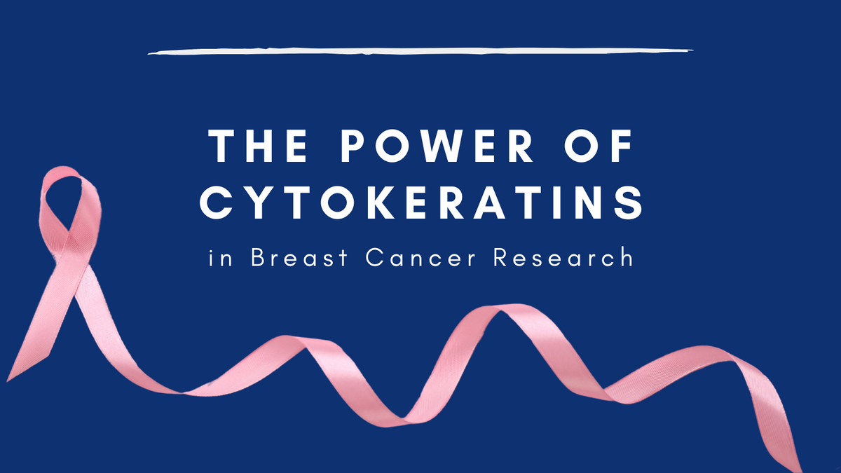 Unveiling The Hidden Secrets Of Breast Cancer The Power Of Cytokerati